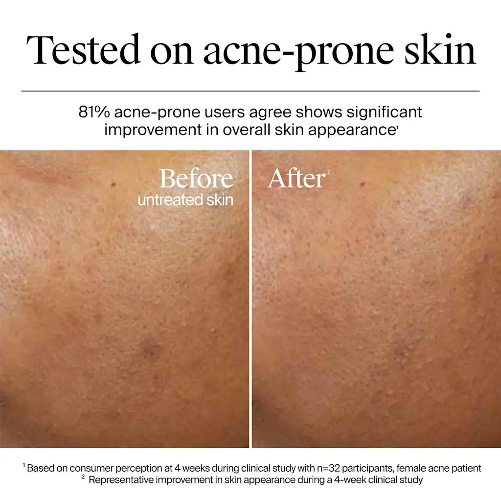 Neutrogena Hydro Boost Hyaluronic Acid Gel Cream Fragrance Free