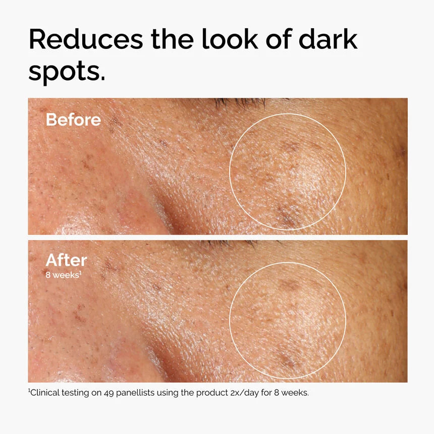 The Ordinary Alpha Arbutin 2% + HA Serum